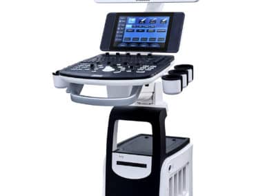 diagnostic ultrasound system Sonos 12
