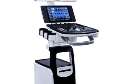 Sonos 12 Système d'échographie diagnostique