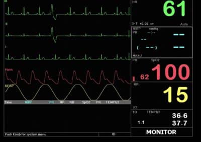 Macs 20 multi parameter patient monitor