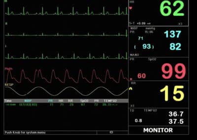 Macs 30 multi parameter patient monitor