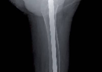 Imagen de rayos X